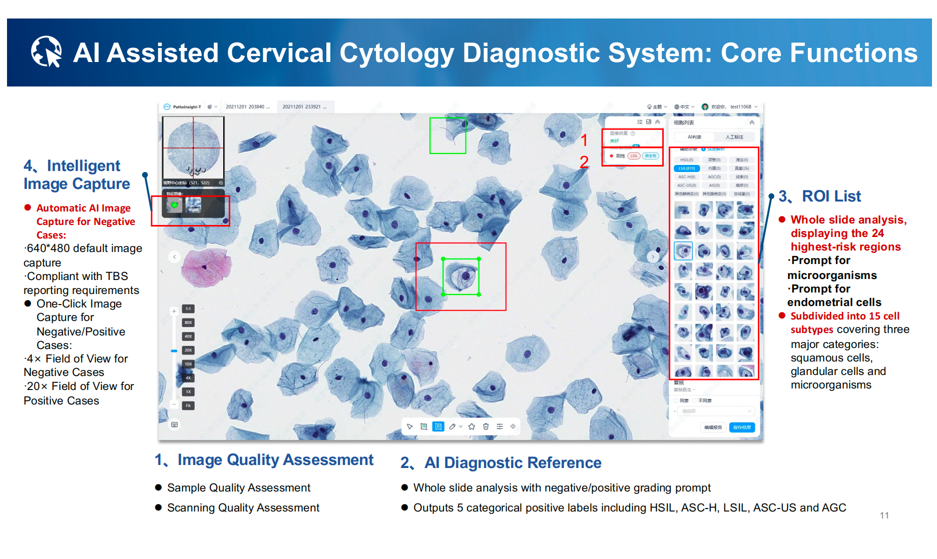 Ứng dụng AI trong giải phẫu bệnh